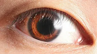 Human_eye,_anterior_view