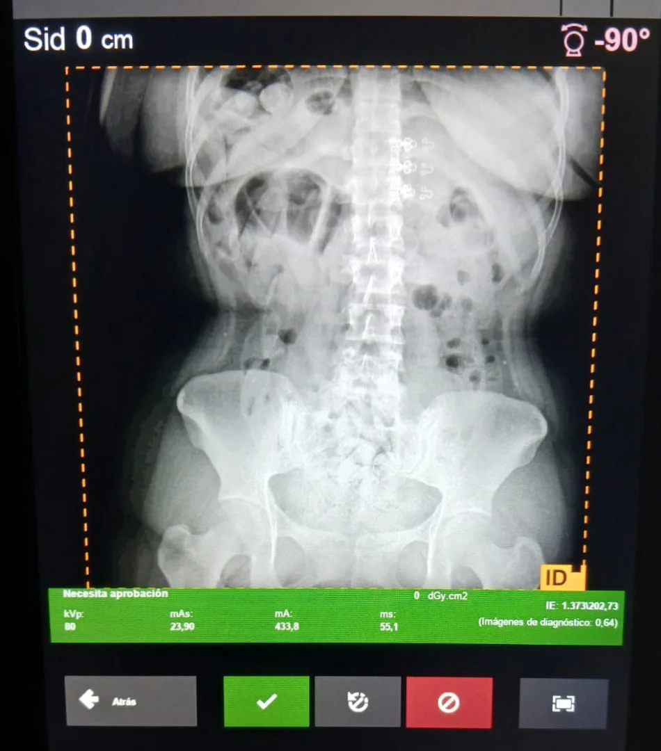 esc_55_tucuman_-_tres_capsuleras-03