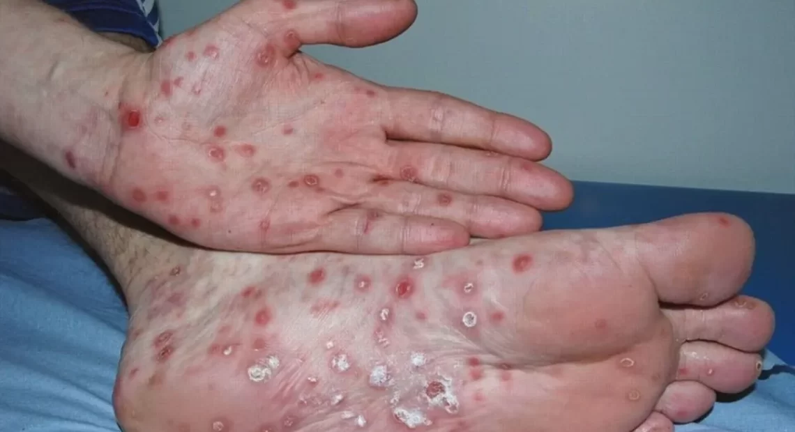 lg-2024-09-03T192153.635-1140x620