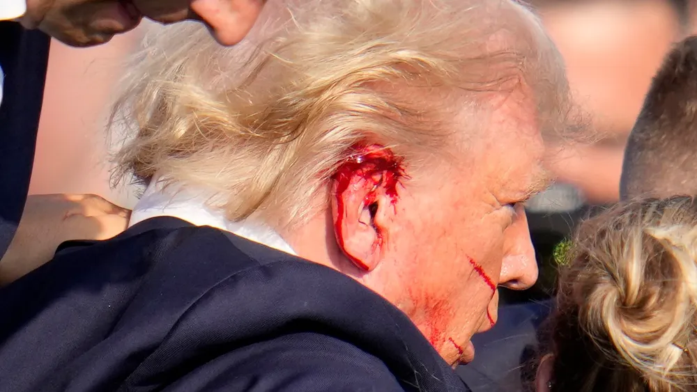 trump-recibido-herida-sus-orejas_98
